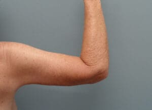 Before & After Pictures in Nashville, TN