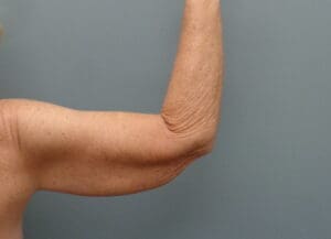 Before & After Pictures in Nashville, TN