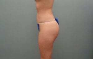 Before & After Pictures in Nashville, TN