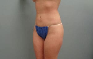 Before & After Pictures in Nashville, TN