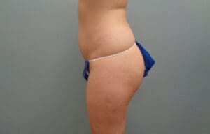 Before & After Pictures in Nashville, TN